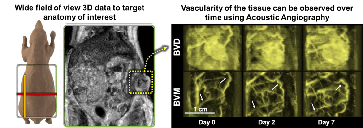 Focused Ultrasound - SonoVol, Inc.